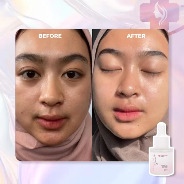 GLASS SKIN SERUM - Gambar 10