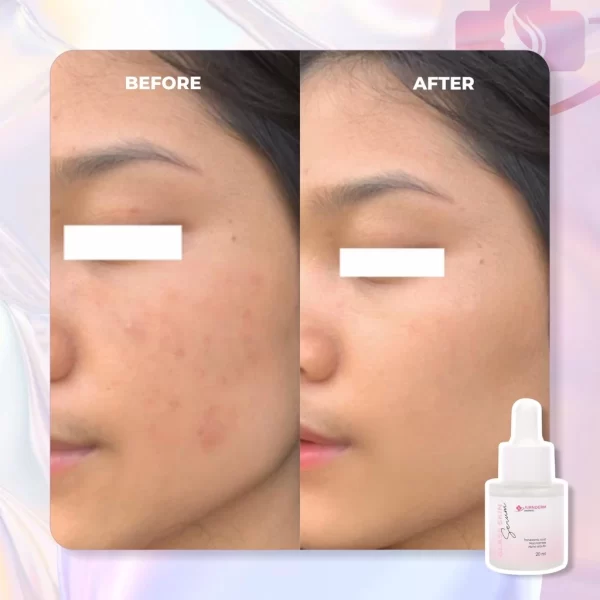 GLASS SKIN SERUM - Gambar 9