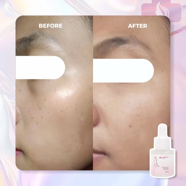 GLASS SKIN SERUM - Gambar 8